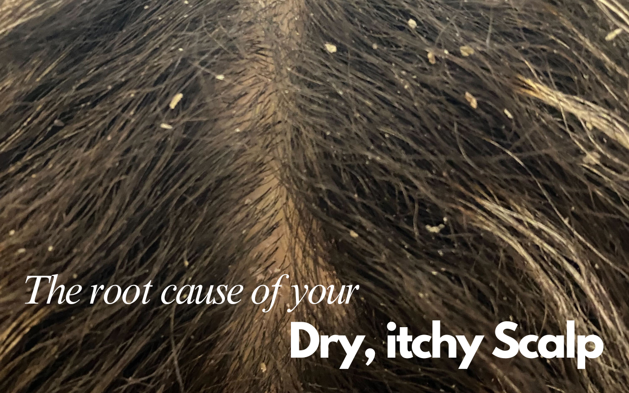 The root cause of your dry itchy scalp