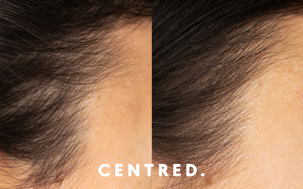 Your Complete Guide to Hair Loss