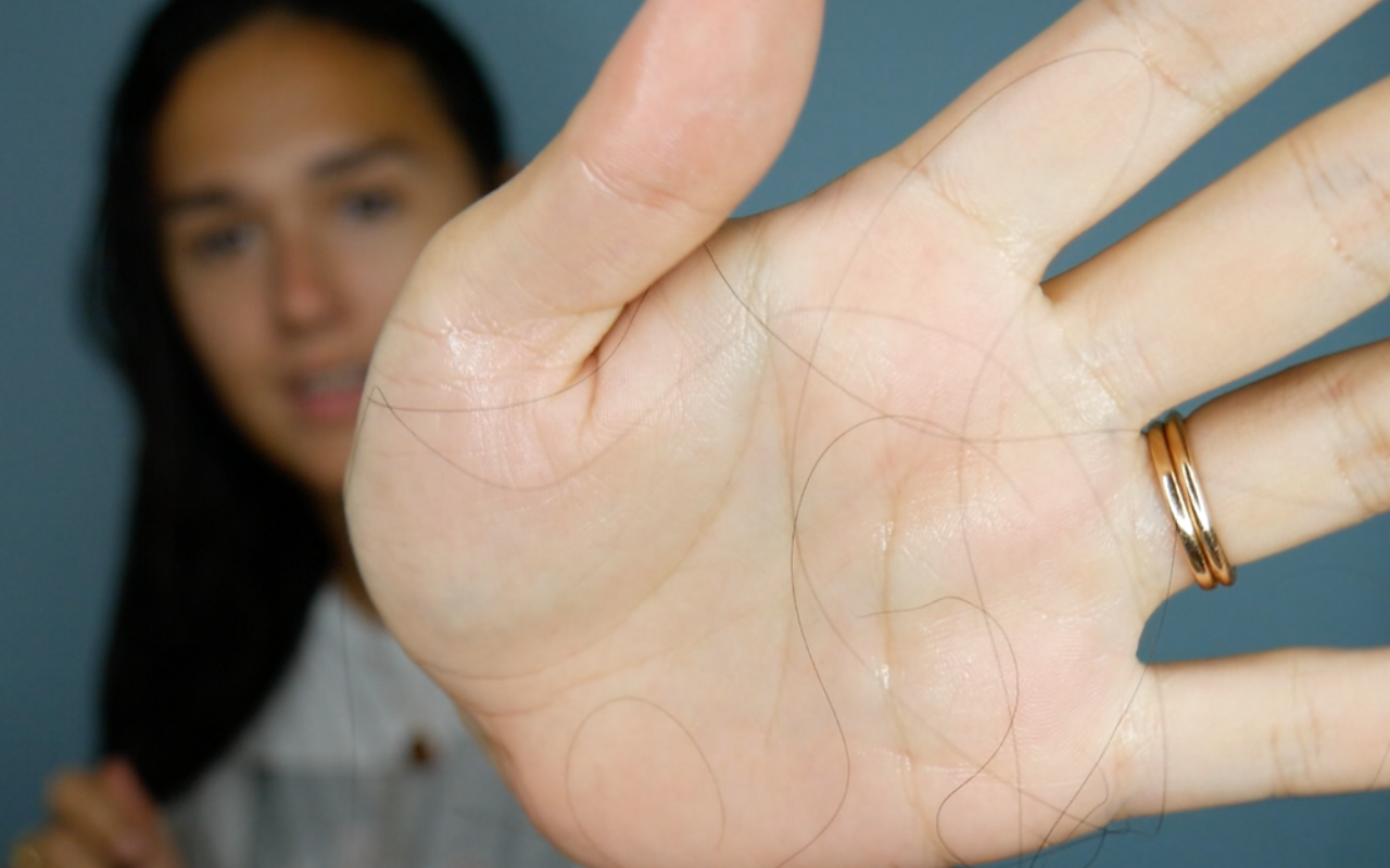 What's with seasonal hair shedding?