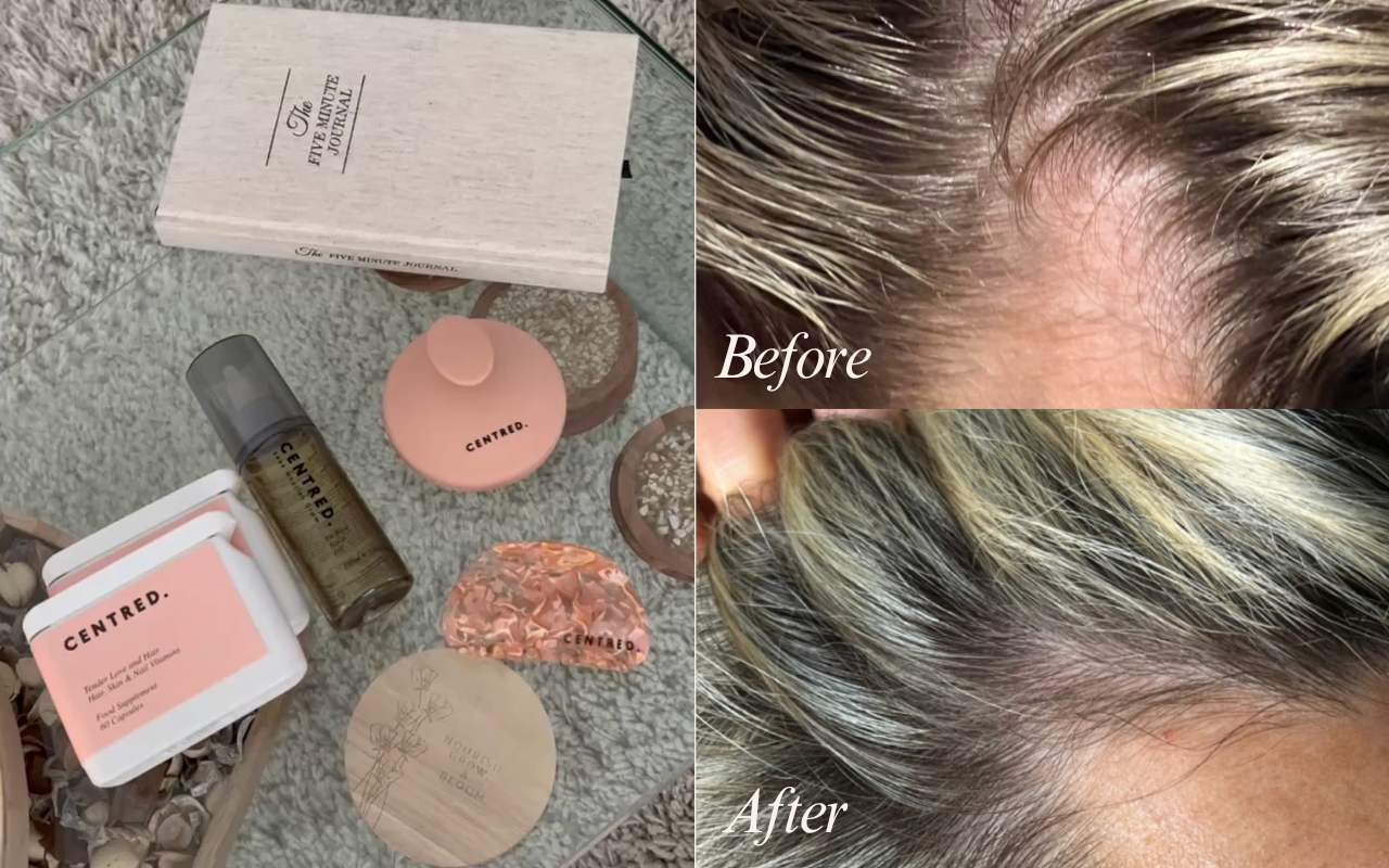 How to stop my hair from falling out deals