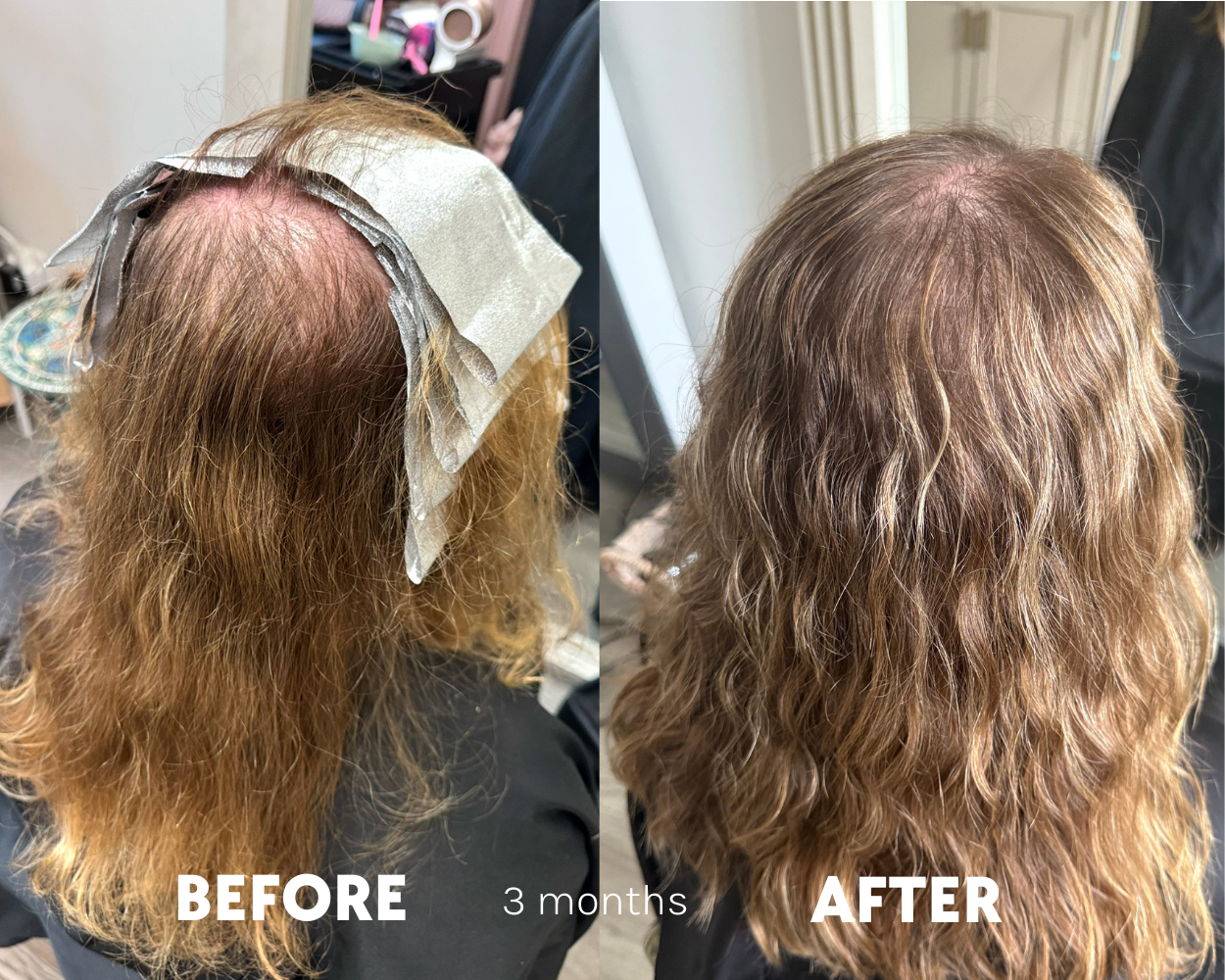 Tender Love and Hair - Menopause Hair Vitamins - 3 Month Supply
