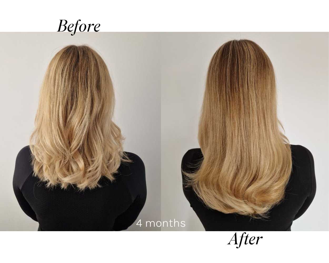 Best Hair Growth Oil