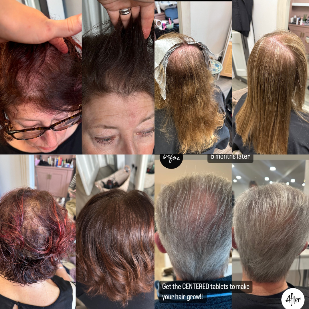 Tender Love and Hair - Menopause Hair Vitamins