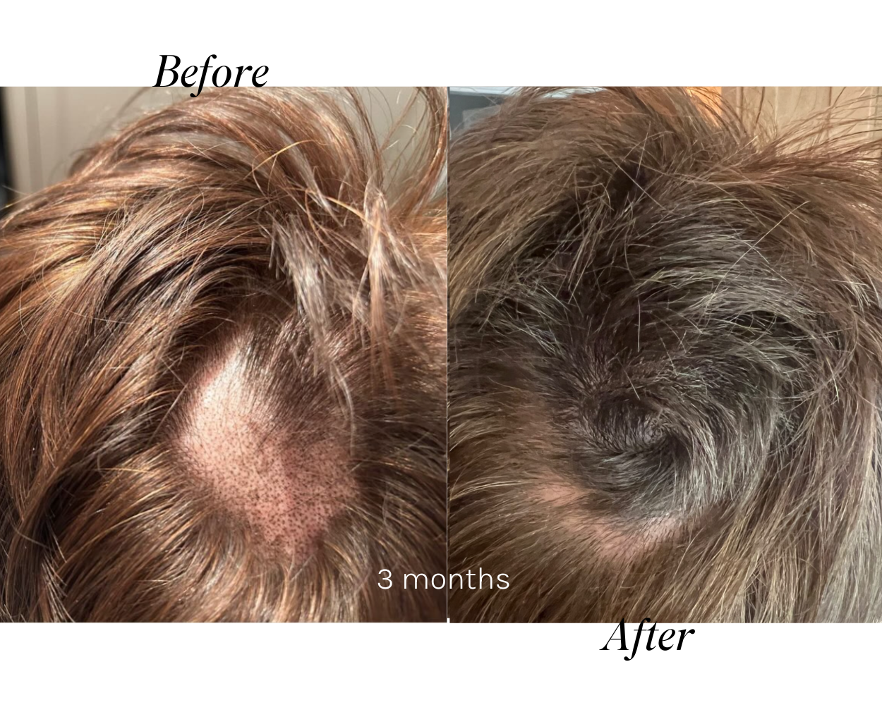 Tender Love and Hair - Menopause Hair Vitamins