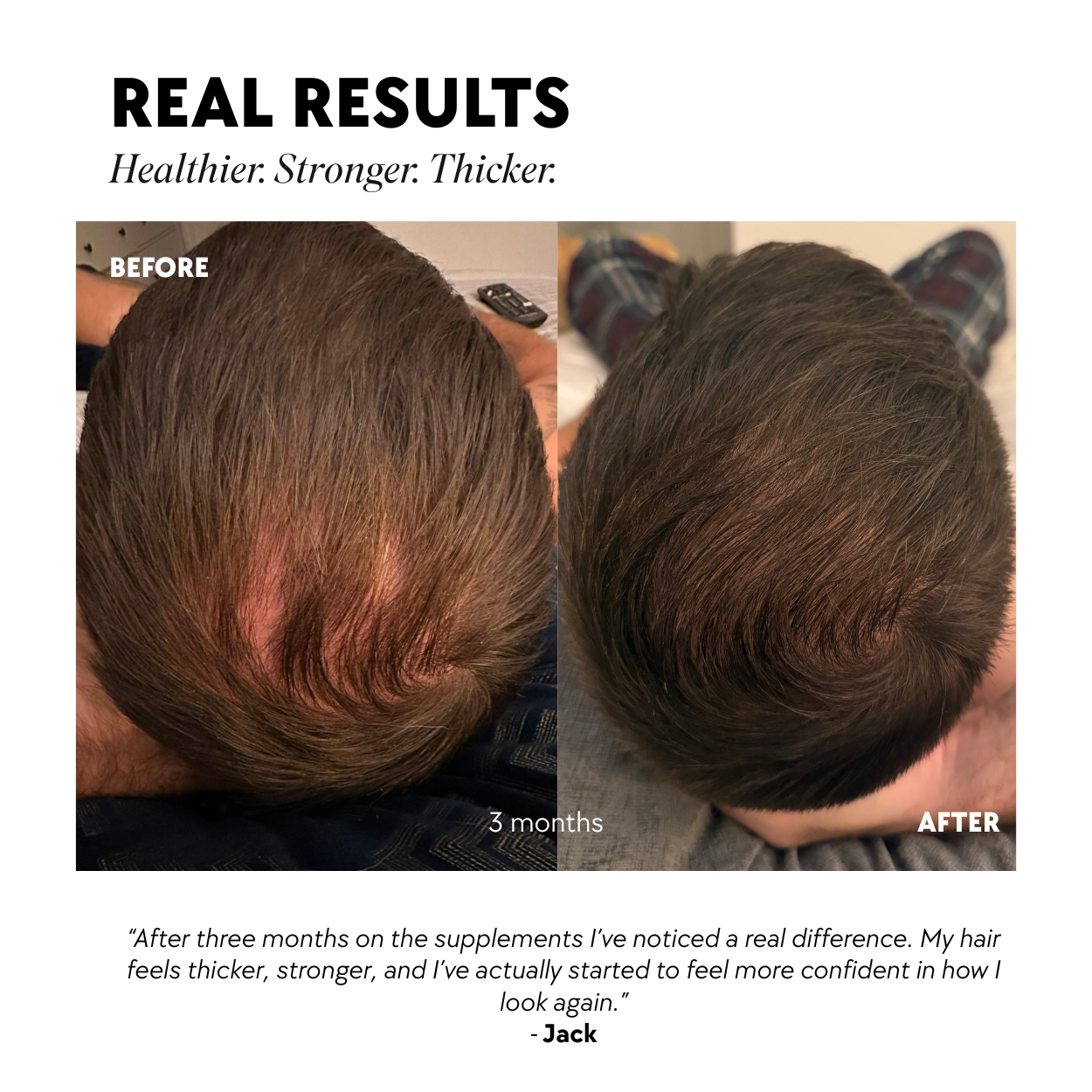 Tender Love and Hair - Men&