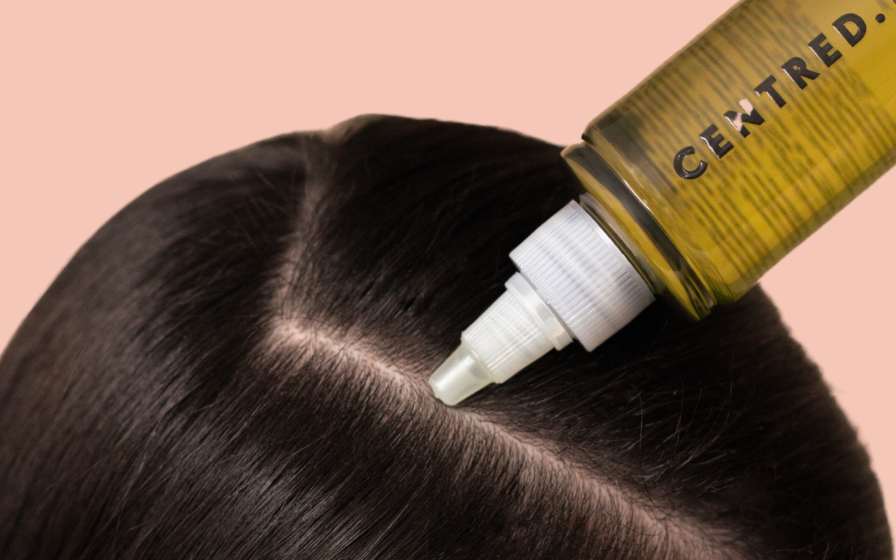 SCALP SOS: YOUR ESSENTIAL GUIDE TO TREATING A TROUBLESOME SCALP