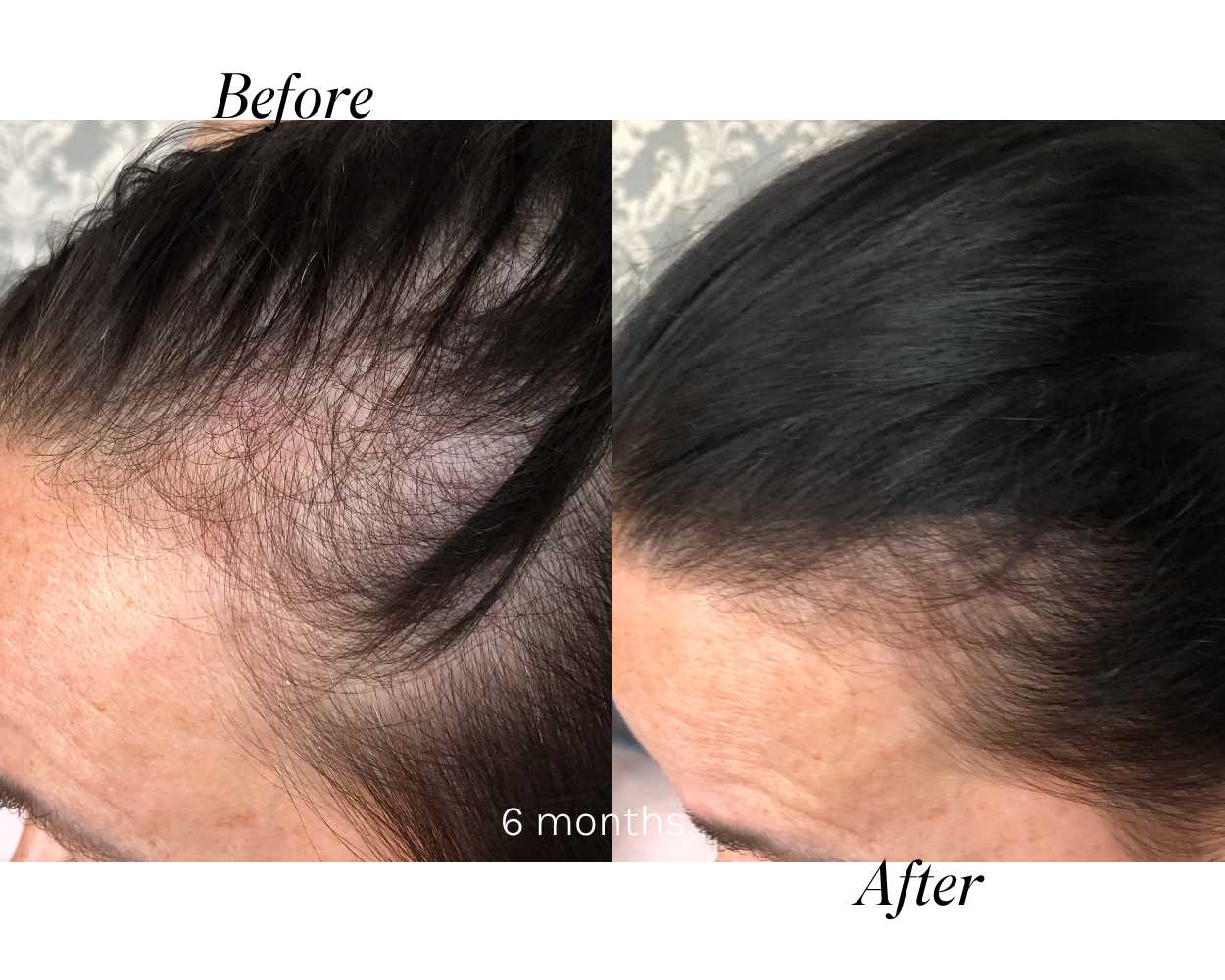 Hair Growth Results Bundle