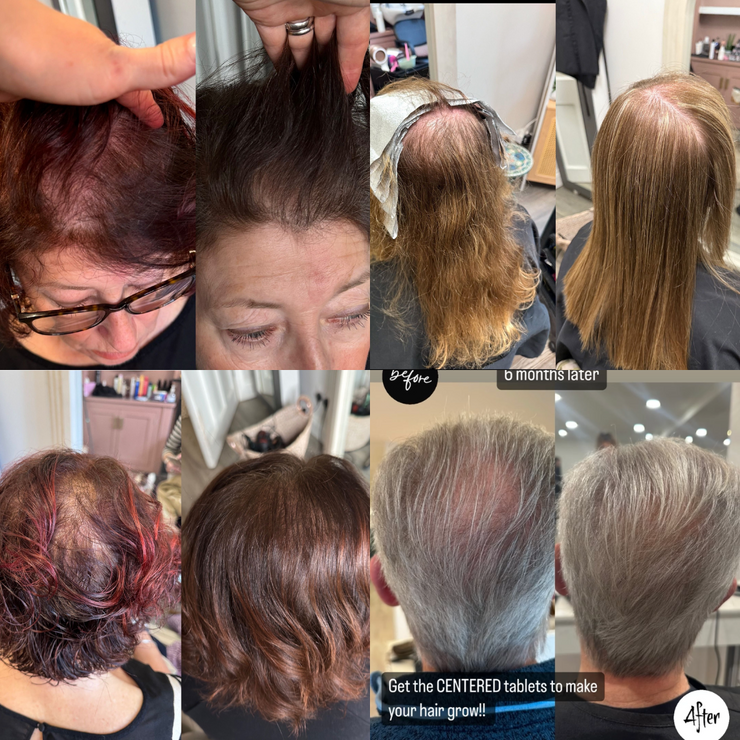 Tender Love and Hair - Menopause Hair Vitamins