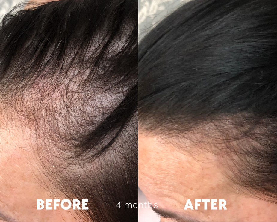 Tender Love and Hair - Menopause Hair Vitamins