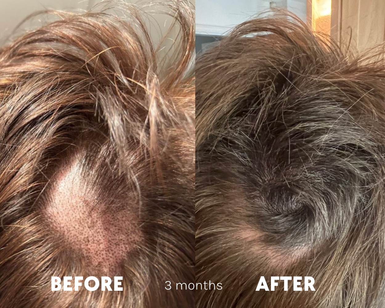 Tender Love and Hair - Menopause Hair Vitamins